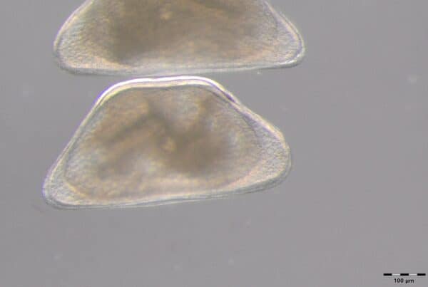 photo de l'ostracode schellencandona : on voit une masse grise vaguement rectangulaire et translucide sur un fond gris